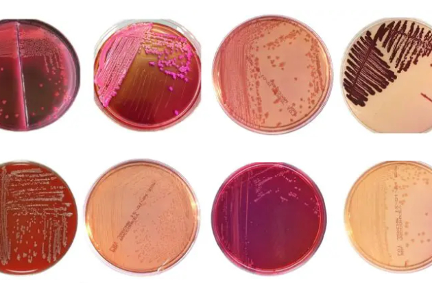 macconkey agar macconkey agar